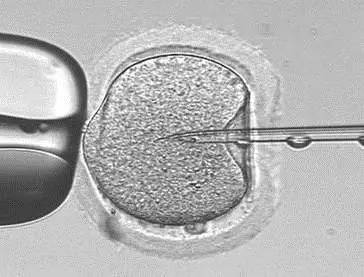 常规体外受精、单精子注射