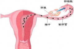 取卵后出现腹胀腹水怎么办